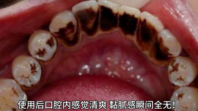 牙，这把高端局